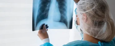 ثورة طبية.. علاج أمريكي جديد لسرطان نادر في الرئة